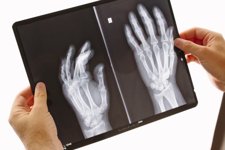 知らないと後悔する歯科矯正の選択肢あなたの常識が人生を左右する